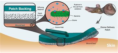 Wearable and Flexible Ozone Generating System for Treatment of Infected Dermal Wounds